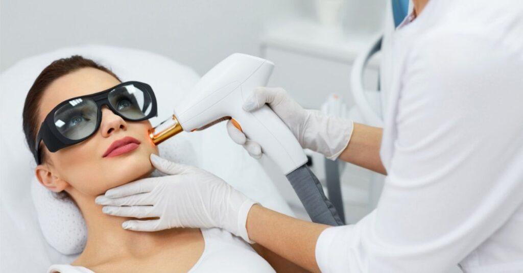 Laser Resurfacing