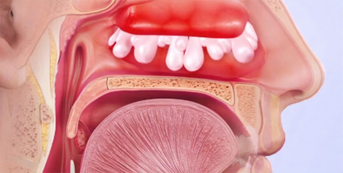 Mucous Membranes