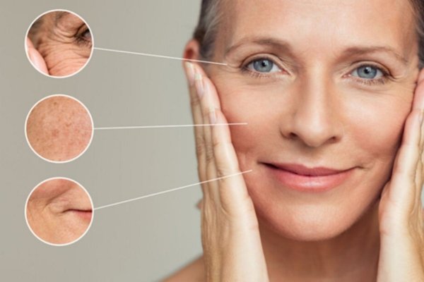 anti-aging treatment at skinzone clinics
