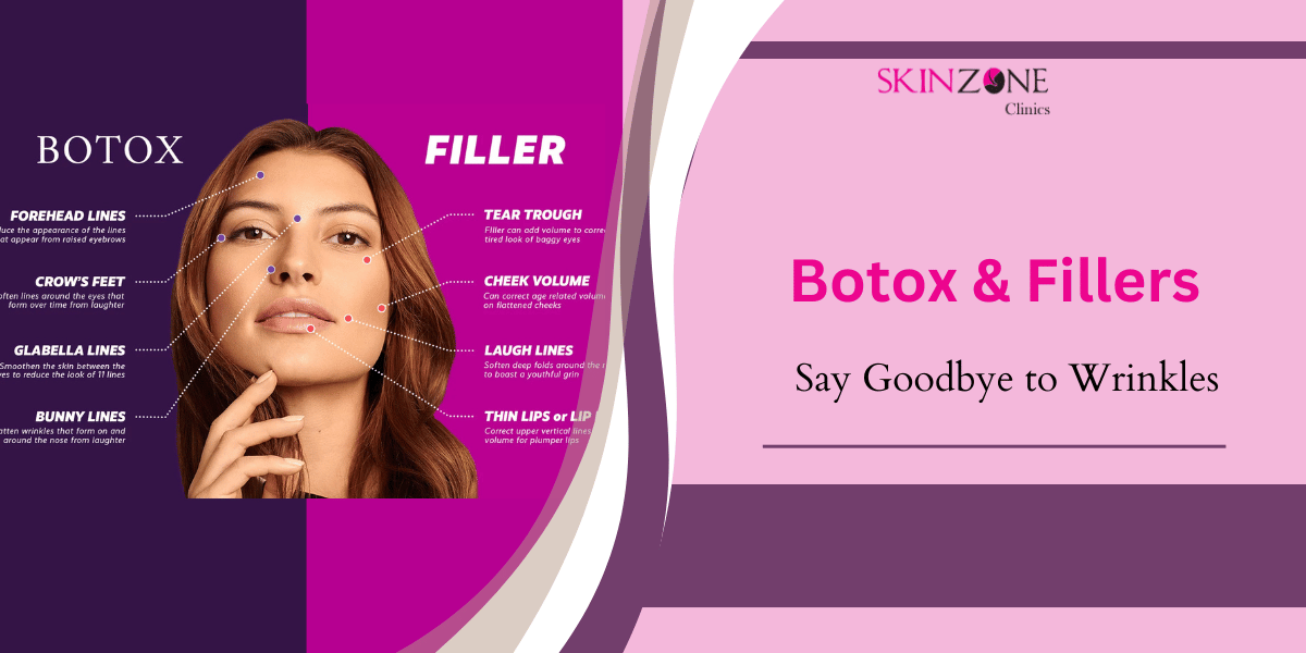 Say Goodbye to Wrinkles with Botox & Fillers