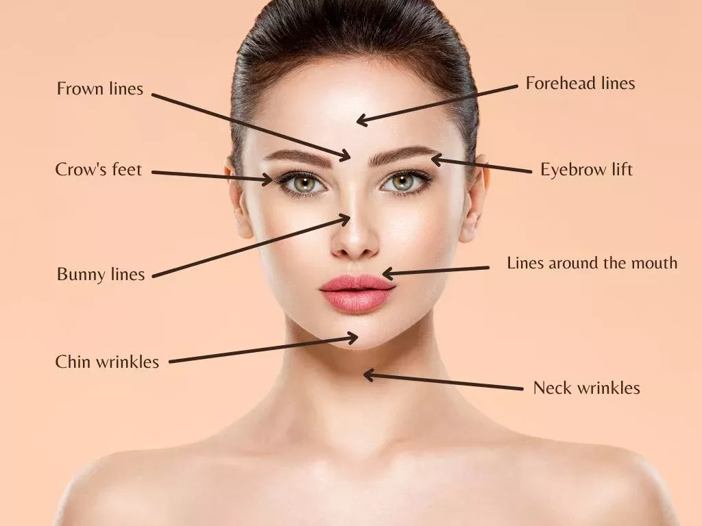 Botox Treatment Areas