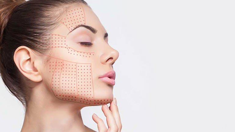 hifu treatment at skinzone clinics