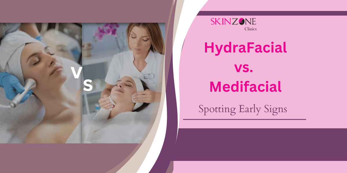 HydraFacial vs Medifacial: What’s Best for You?
