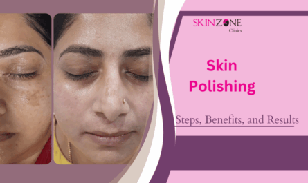 Skin Polishing Treatment Explained: Steps, Benefits, and Results