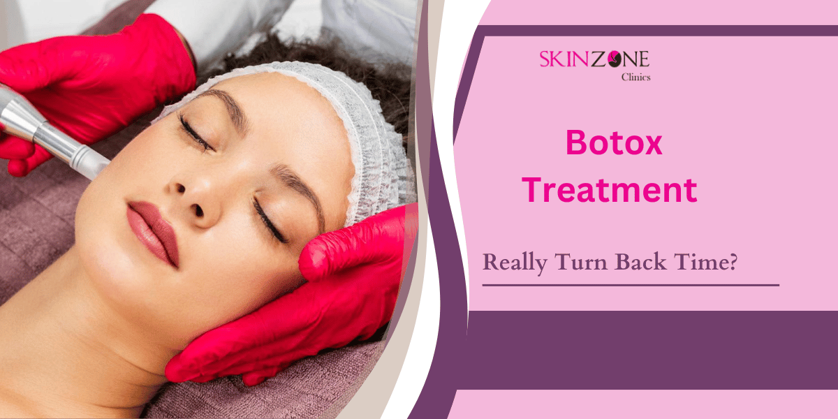 Can Botox Really Turn Back Time?