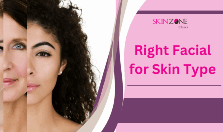How to Choose the Right Facial for Your Skin Type and Tan Concerns?