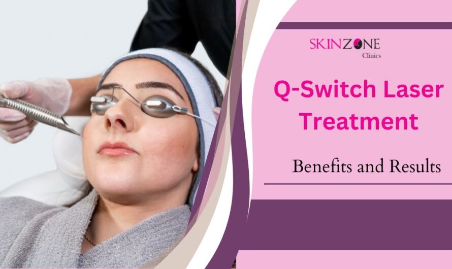 What Is Q-Switch Laser Treatment? Discover the Benefits and Results