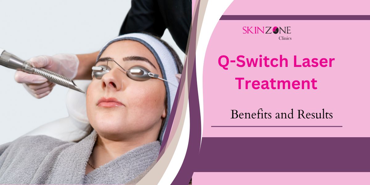 What Is Q-Switch Laser Treatment? Discover the Benefits and Results