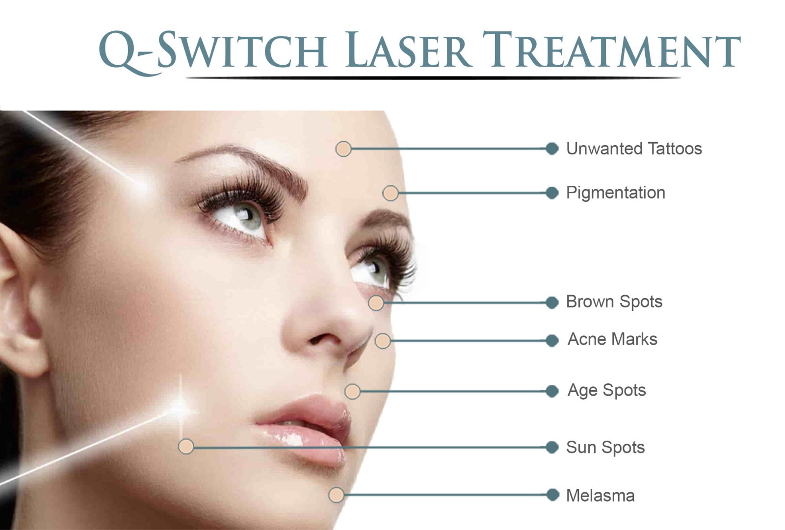 What Is Q-Switch Laser Treatment?