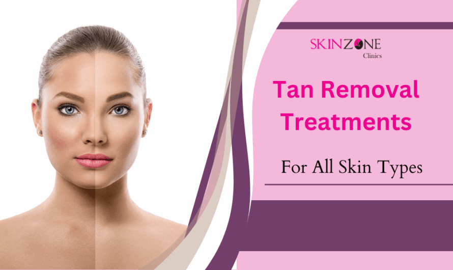 Best Tan Removal Treatments for All Skin Types