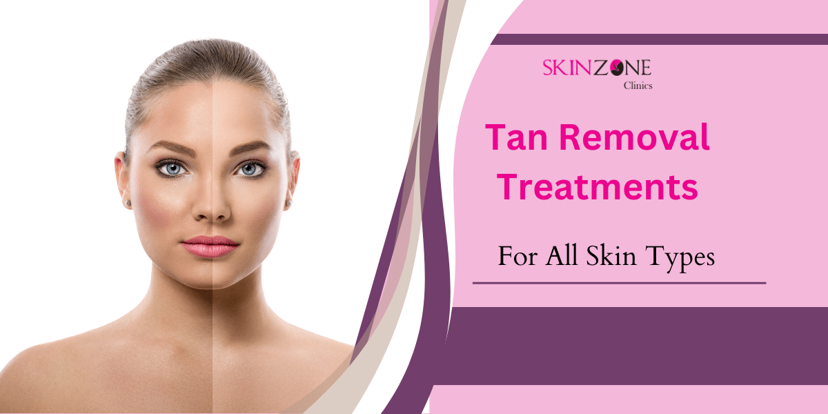 Best Tan Removal Treatments for All Skin Types