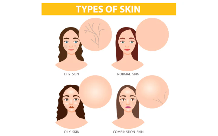 Understanding Your Skin Type at Skinzone clinics