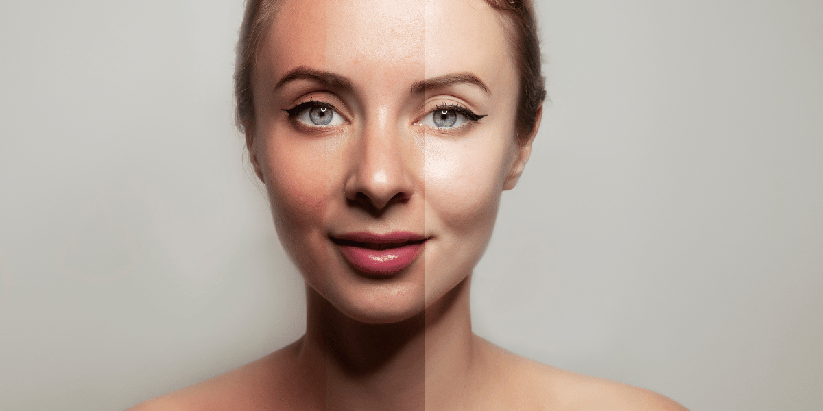 Why Tan Removal is Important.