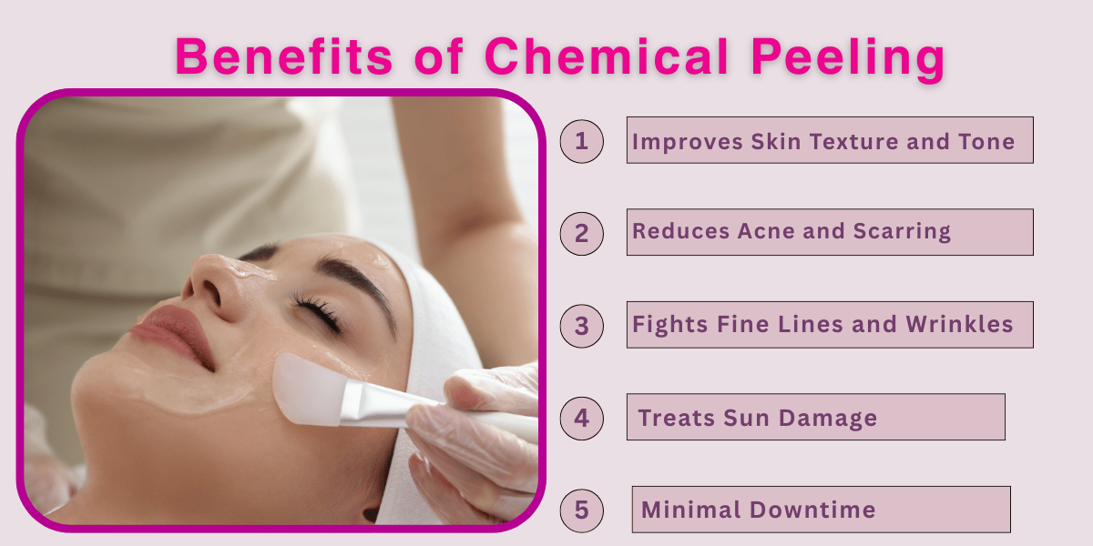 Benefits of Chemical Peeling