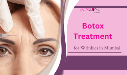 Best Botox Treatment for Wrinkles in Mumbai