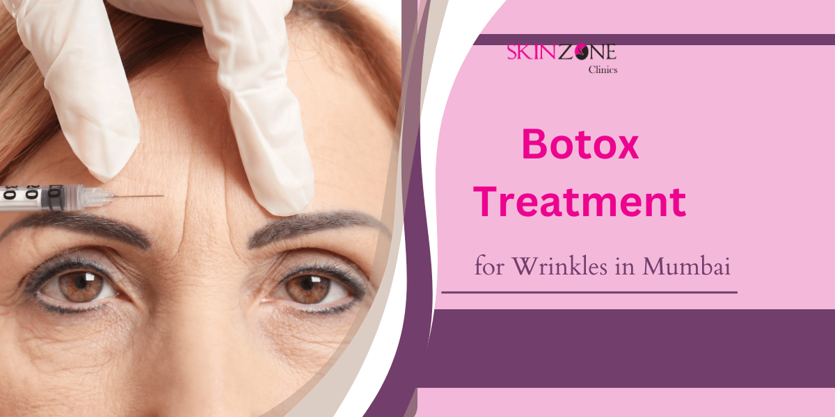 Best Botox Treatment for Wrinkles in Mumbai