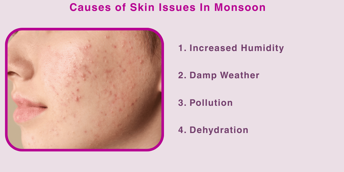 Causes of Skin Issues In Monsoon learn with skinzone clinics