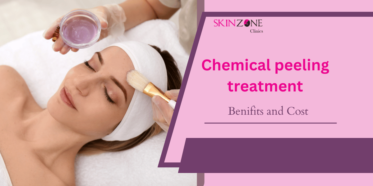 Chemical peeling treatment in Mumbai : Benifits and Cost