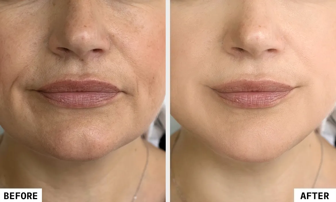 Key Specializations at Skinzone Clinics
