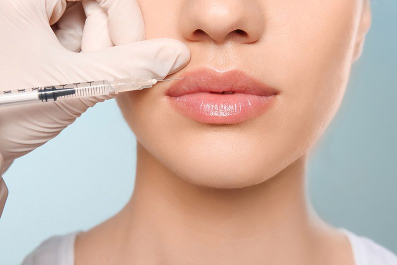 What are Derma Fillers?
