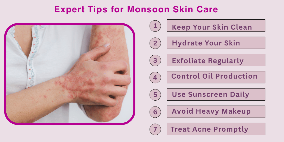 Expert Tips for Monsoon Skin Care