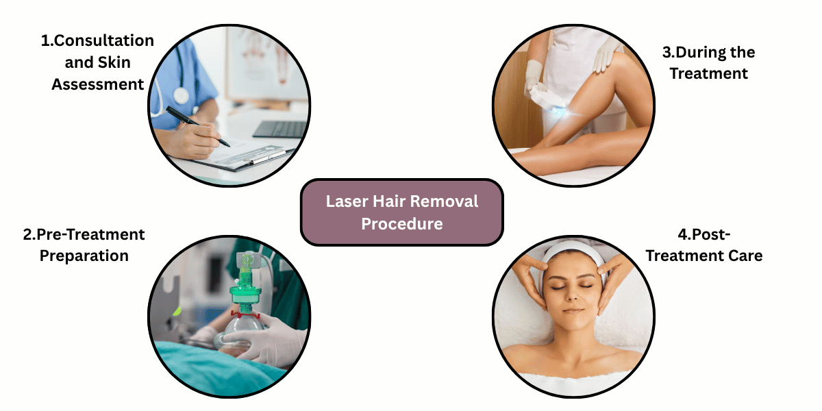 The Laser Hair Removal Procedure at skincone clinics