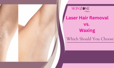 Laser Hair Removal vs. Waxing: Which One Should You Choose?