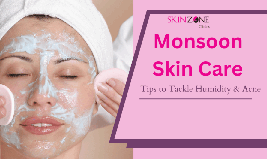Monsoon Skin Care in Mumbai: Expert Tips to Tackle Humidity & Acne