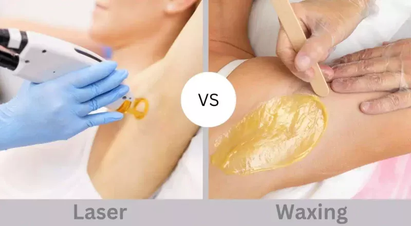 Key Differences Between Laser Hair Removal and Waxing