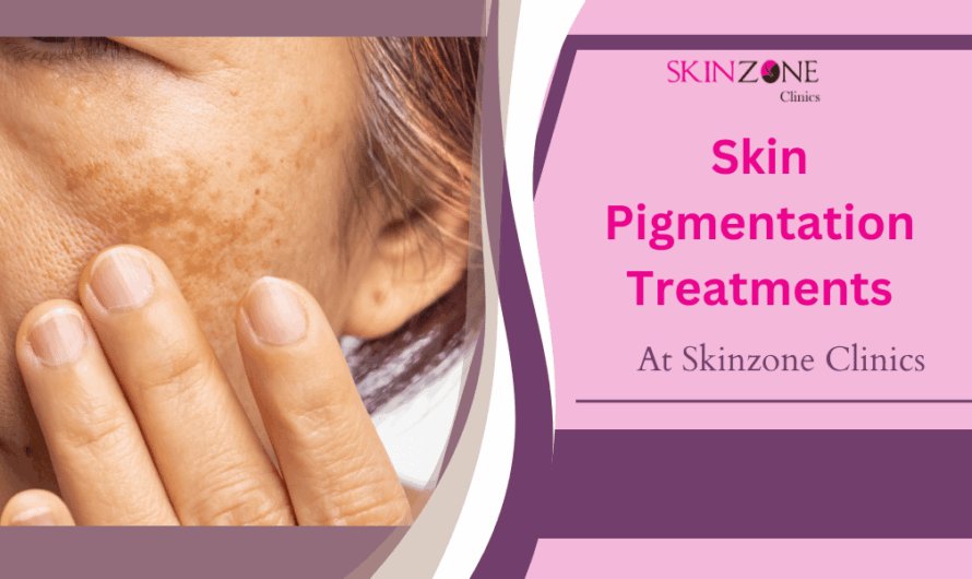 Personalized Skin Pigmentation Treatments for Better Results at Skinzone Clinics