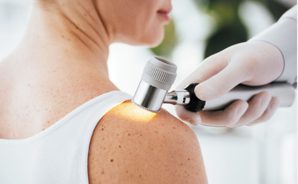 What Happens During a Skin Checkup?