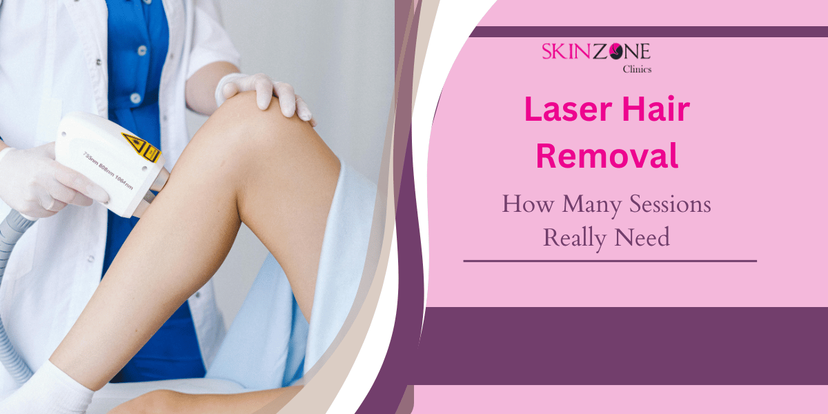 How Many Laser Hair Removal Sessions Do You Really Need?