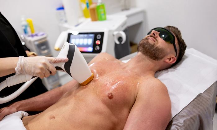 Is Laser Hair Removal Permanent?