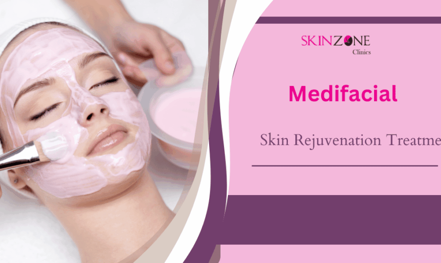 Medifacial: The Ultimate Skin Rejuvenation Treatment