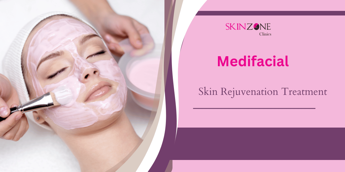 Medifacial: The Ultimate Skin Rejuvenation Treatment