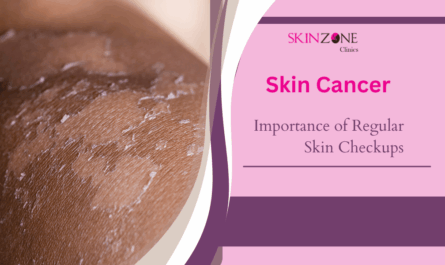 The Importance of Regular Skin Checkups: Preventing Skin Cancer
