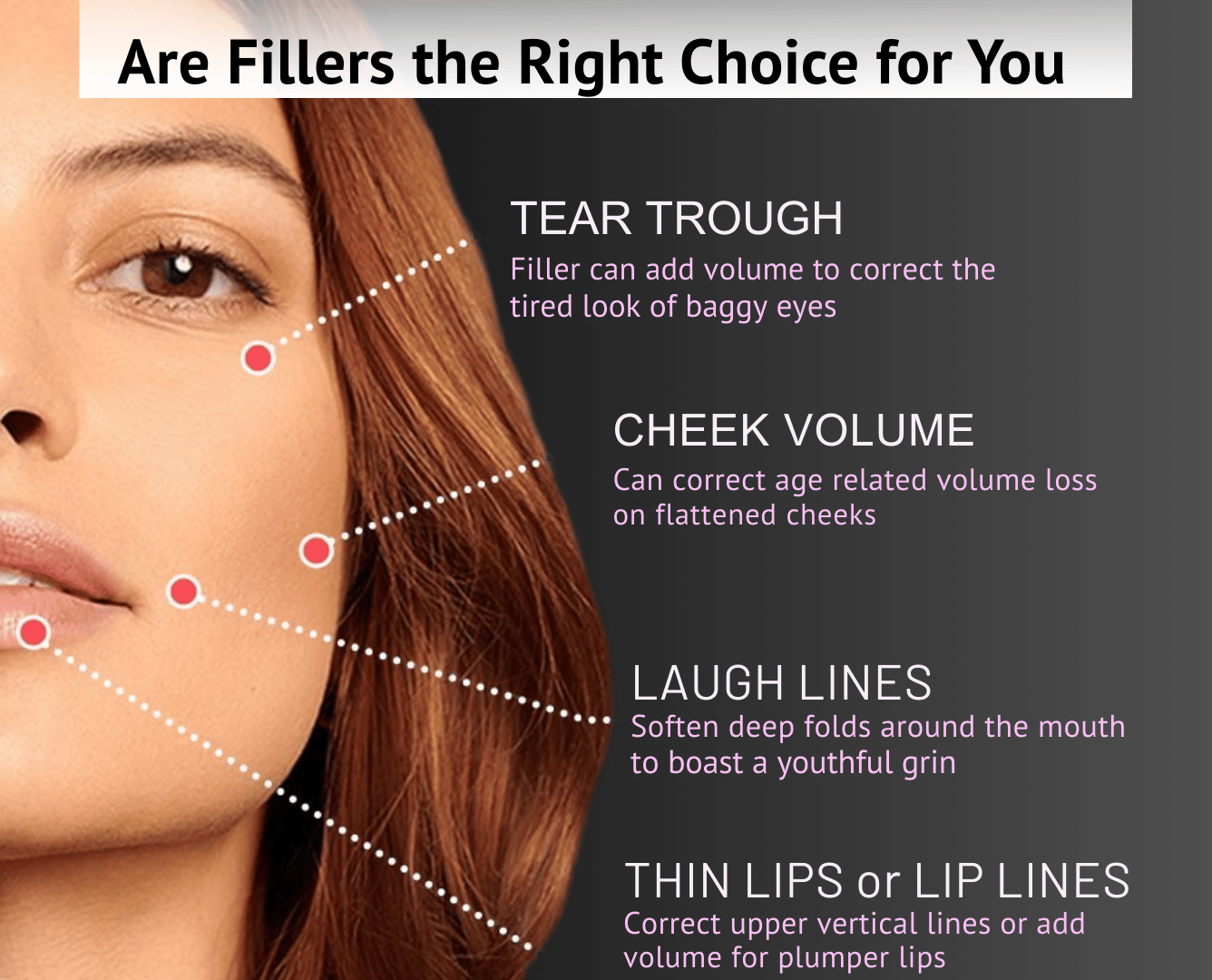 Are Fillers the Right Choice for You
