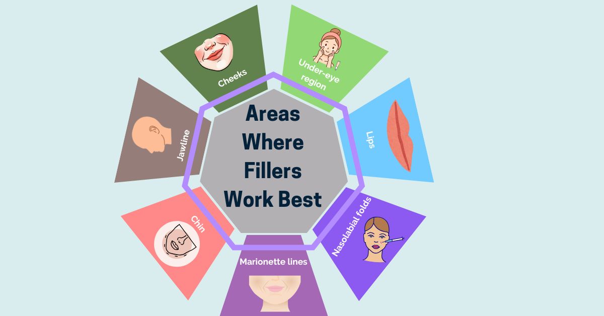 Areas Where Fillers Work Best