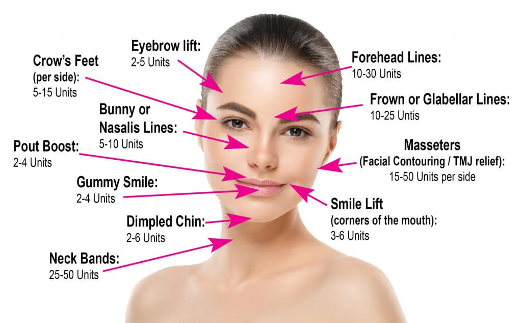 How Long Does Botox Usually Last?