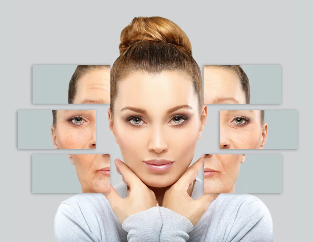Does Botox Last Longer After Repeated Sessions?