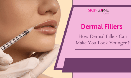 How Dermal Fillers Can Make You Look Younger ?