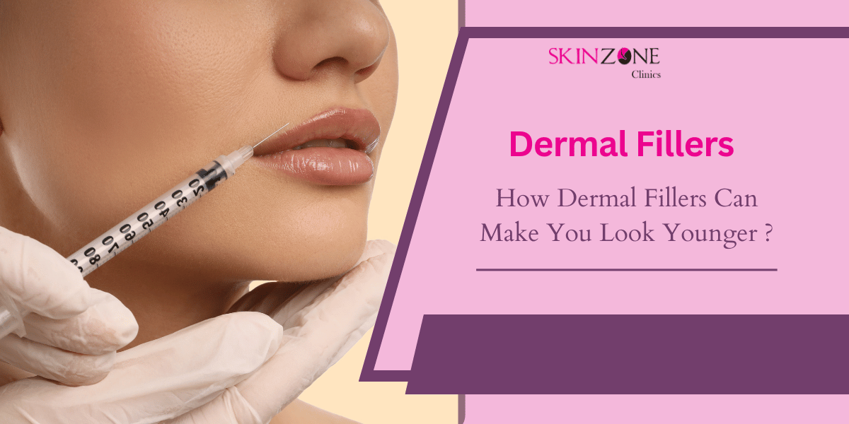How Dermal Fillers Can Make You Look Younger ?