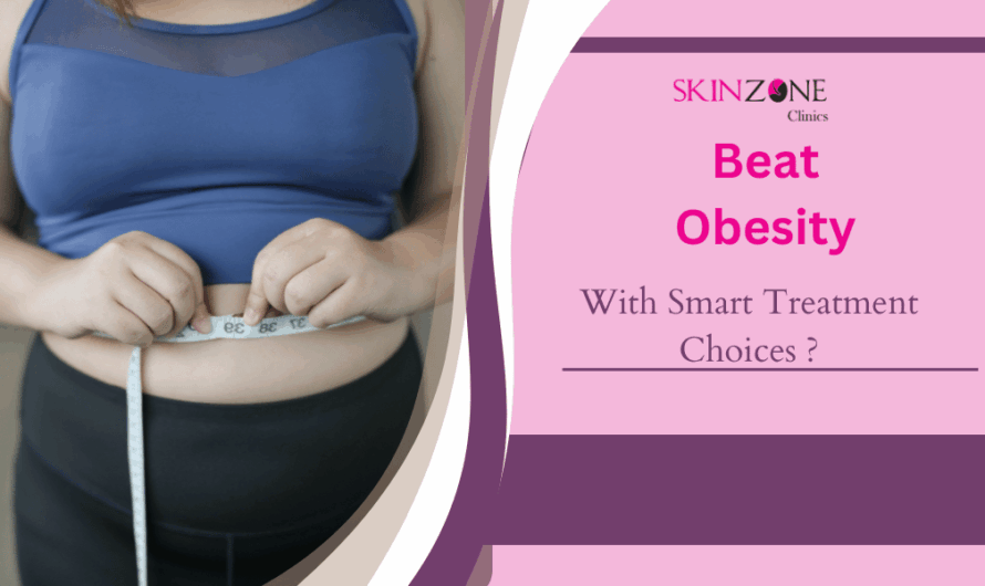 How to Beat Obesity With Smart Treatment Choices ?