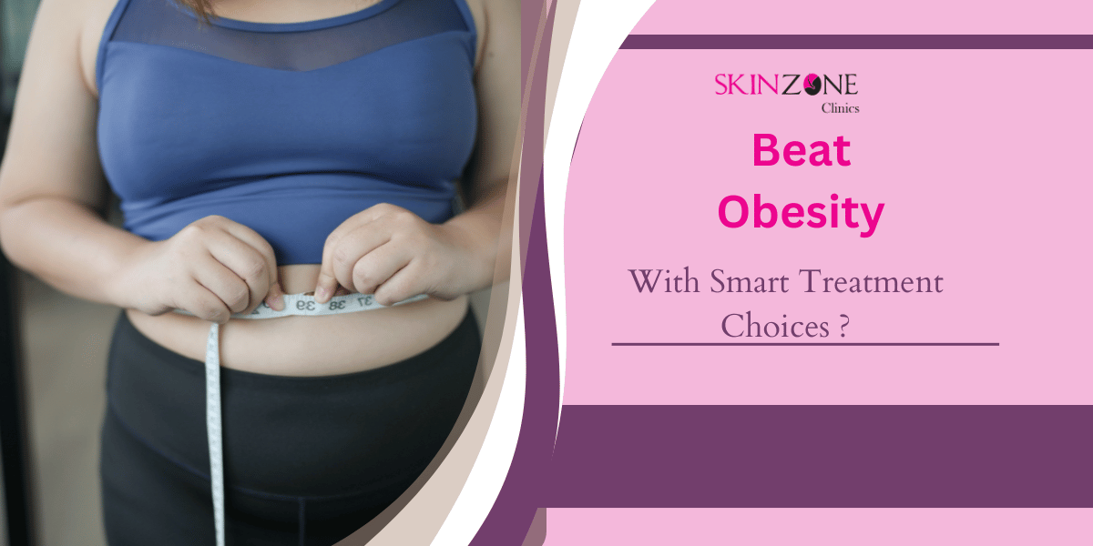 How to Beat Obesity With Smart Treatment Choices ?