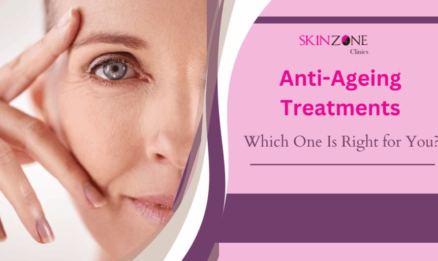 Anti-Ageing Treatments: Which One Is Right for You?