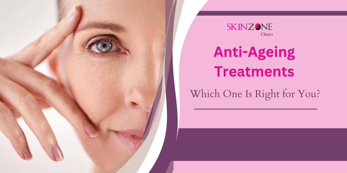 Anti-Ageing Treatments: Which One Is Right for You?
