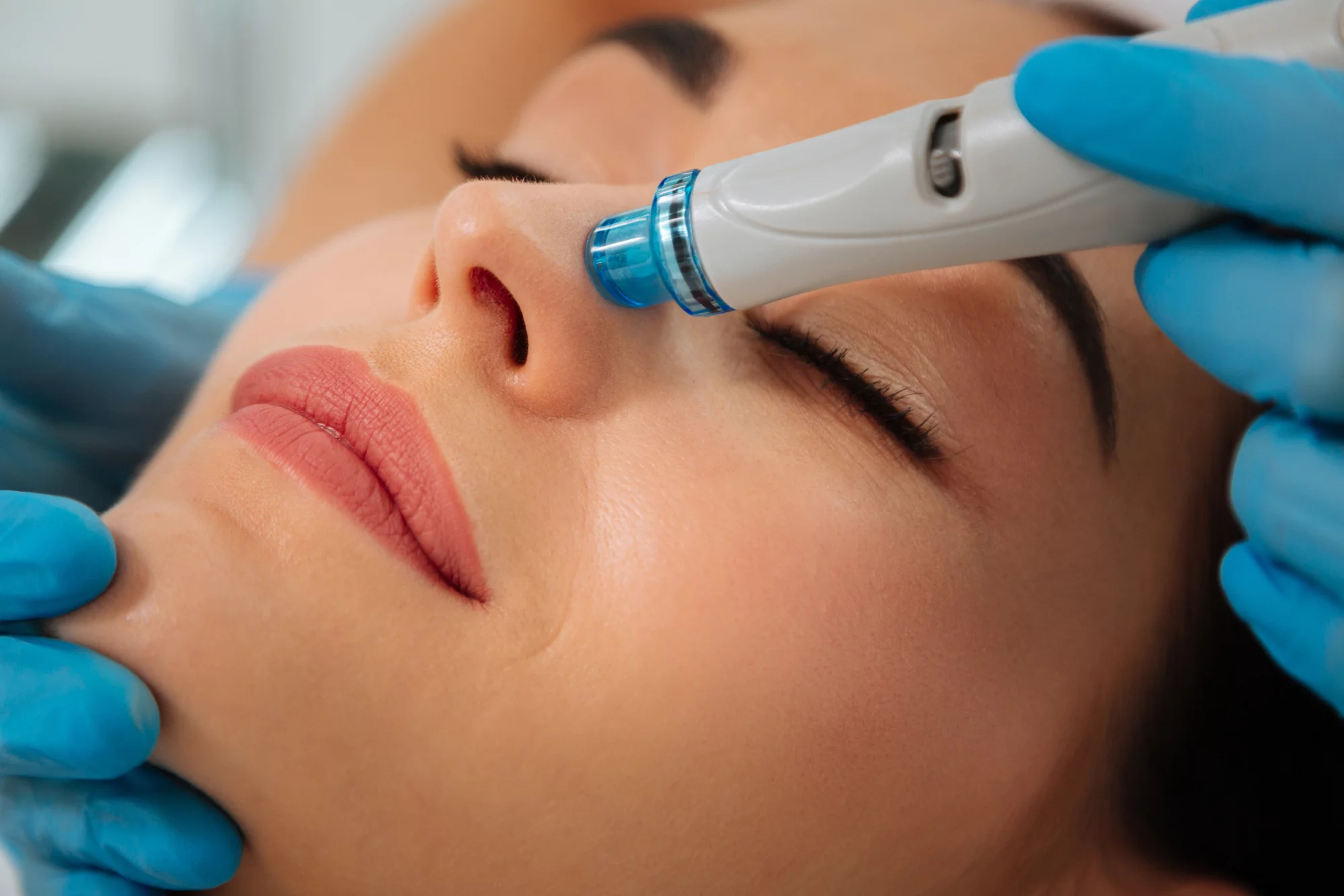 Why is Hydrafacial So Popular?