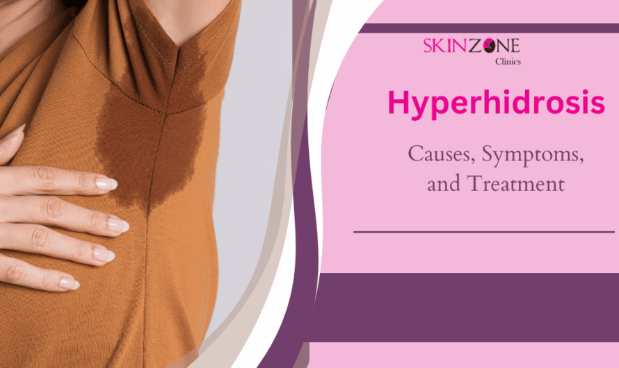 Hyperhidrosis: Causes, Symptoms, and When to Seek Treatment