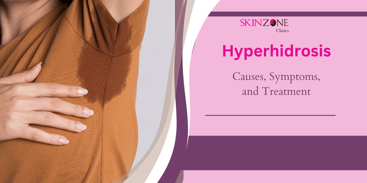 Hyperhidrosis: Causes, Symptoms, and When to Seek Treatment