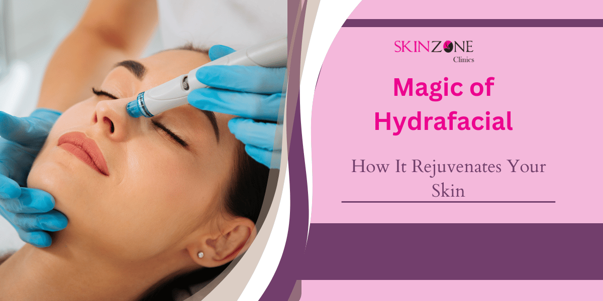 The Magic of Hydrafacial: How It Rejuvenates Your Skin